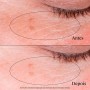 Neutrogena Collagen Bank Contorno de Olhos Revitalizante 15g